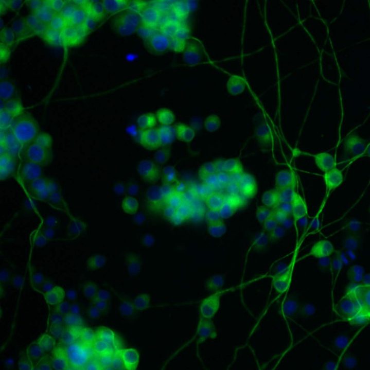 High Content Screening (HCS) Microplates Corning